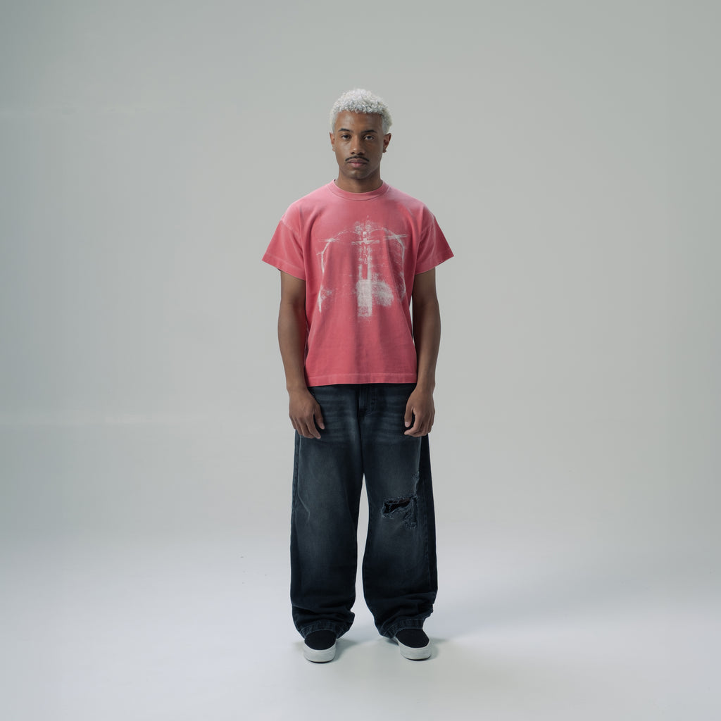 RADIOGRAPHIE TEE