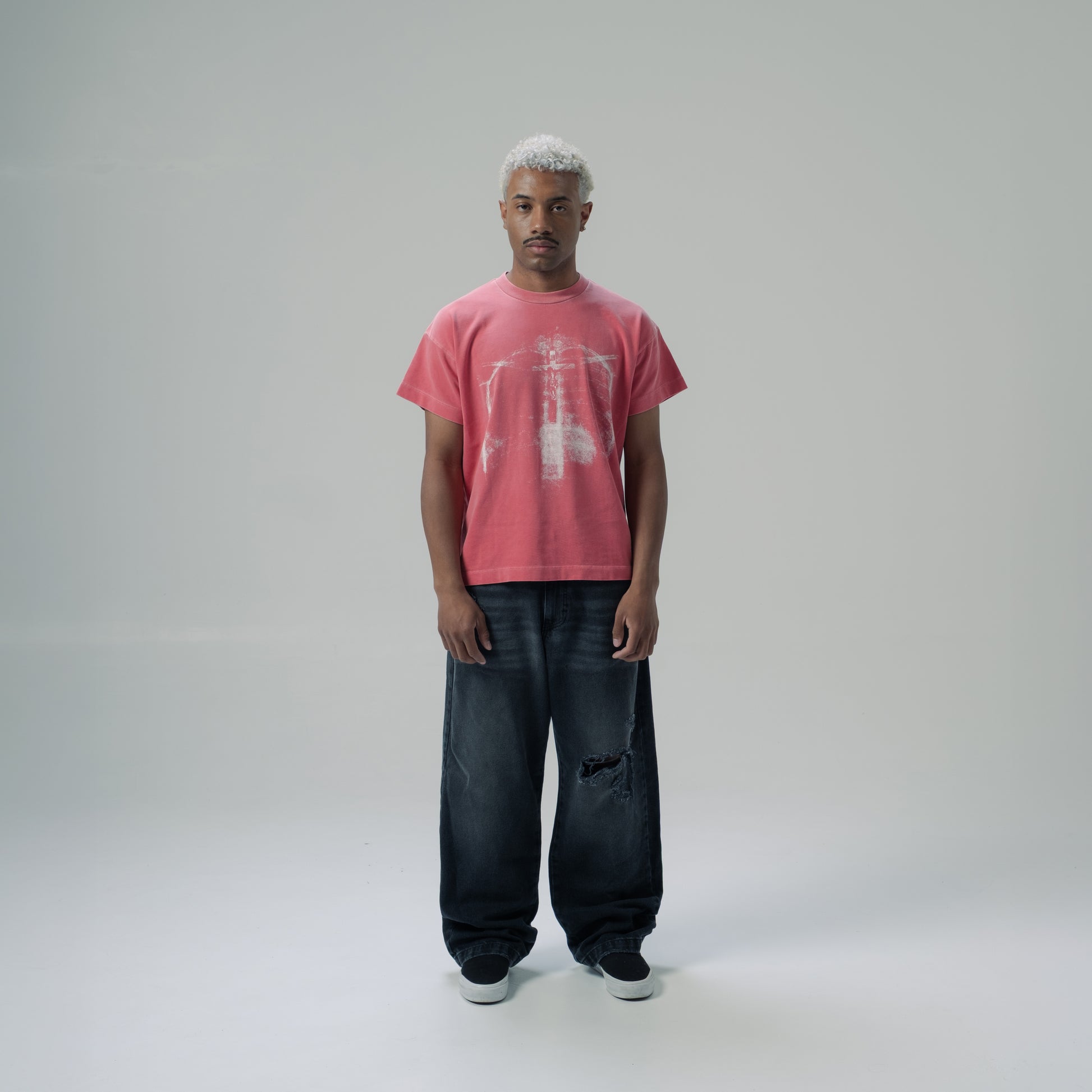 RADIOGRAPHIE TEE